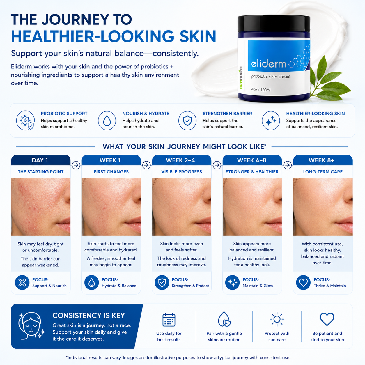 Eliderm Topical Probiotic Skin Cream – 4oz Microbiome Moisturizer for Dry, Sensitive & Stressed Skin